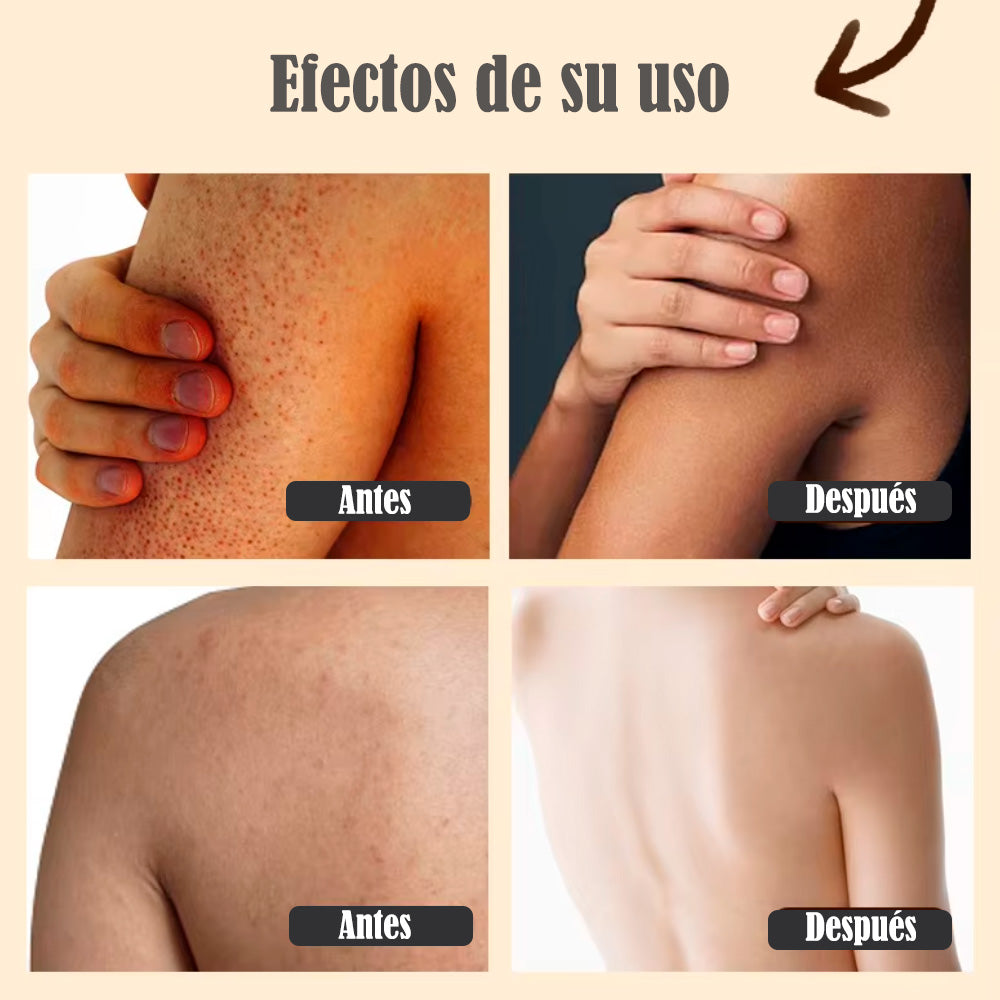 Exfoliante Corporal Anticelulitis de Café