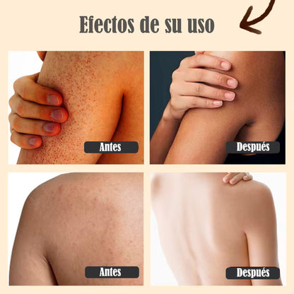Exfoliante Corporal Anticelulitis de Café